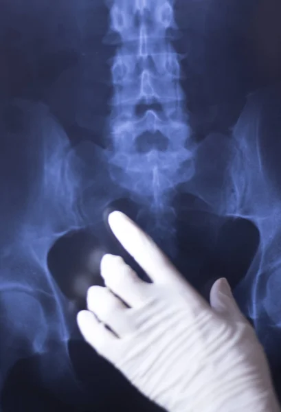医疗医院 线背痛脊柱和髋部创伤扫描 — 图库照片