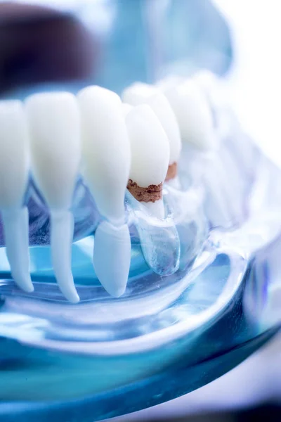 Dentist Dental Teeth Teaching Model Showing Each Tooth Gum Patients — Stock Photo, Image