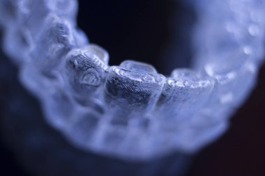 Kozmetik diş hekimliğinde hastalar için dişleri hizalamak için kullanılan görünmez diş düzenleyiciler.