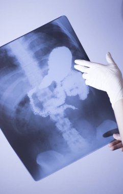 Tıbbi hastane röntgen lowe geri ağrı da mide ve organları gösteren omurga ve kalça Travmatoloji tarama.