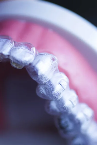 Allineatori Dentali Invisibili Staffe Utilizzate Allineare Ogni Dente Odontoiatria Estetica — Foto Stock