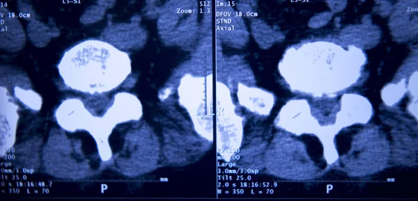 Radiografia Hospitalar Médica Quadris Coluna Pélvis Ressonância Magnética Traumatologia — Fotografia de Stock