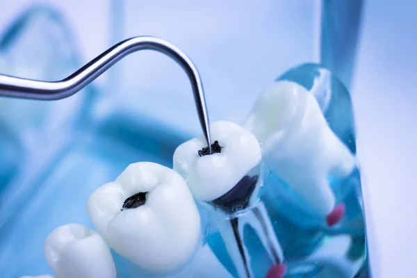 Dentista Limpieza Dientes Con Instrumento Selección Dientes Metal Titanio Para —  Fotos de Stock