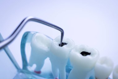 Titanyum metal diş hekimi temizlik dişler plak ve çürüme kaldırmak için araç almak.