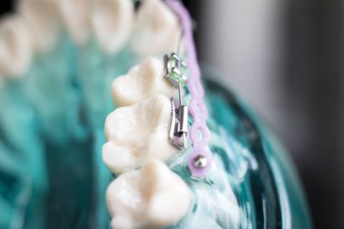 Diş metal diş teli Ortodonti modeli öğretim diş telini aligners.
