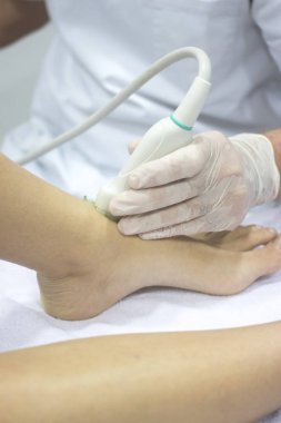 Fizyoterapi kliniği Doku İçi Perkütanöz Elektroliz EPI Kuru iğneli fizyoterapist yaralanması.