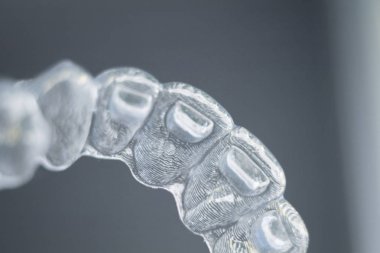 Kozmetik diş hekimliğinde hastalar için dişleri hizalamak için kullanılan görünmez diş düzenleyiciler.