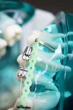 Diş metal diş teli Ortodonti modeli öğretim diş telini aligners.