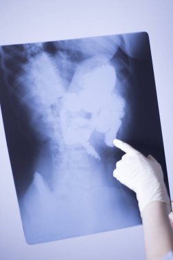 Tıbbi hastane röntgen lowe geri ağrı da mide ve organları gösteren omurga ve kalça Travmatoloji tarama.