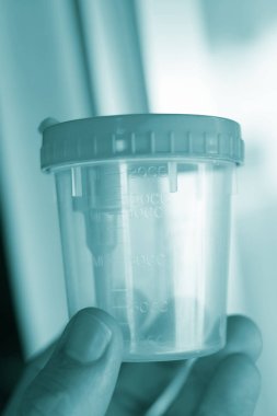 Tıbbi idrar testi Kupası hasta uyuşturucu ilaç test tutmak için örnek.