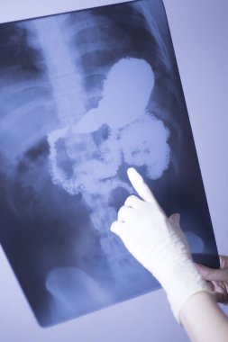 Tıbbi hastane röntgen lowe geri ağrı da mide ve organları gösteren omurga ve kalça Travmatoloji tarama.