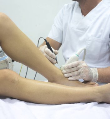 Fizyoterapi kliniği Doku İçi Perkütanöz Elektroliz EPI Kuru iğneli fizyoterapist yaralanması.