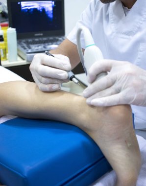 Fizyoterapi kliniği Doku İçi Perkütanöz Elektroliz EPI Kuru iğneli fizyoterapist yaralanması.