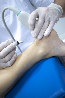 Fizyoterapi kliniği Doku İçi Perkütanöz Elektroliz EPI Kuru iğneli fizyoterapist yaralanması.