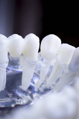 Diş hekimi diş diş modeli gösteren öğretim her diş ve dişeti hastalar ve öğrenciler için.