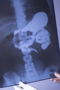 Tıbbi hastane röntgen lowe geri ağrı da mide ve organları gösteren omurga ve kalça Travmatoloji tarama.