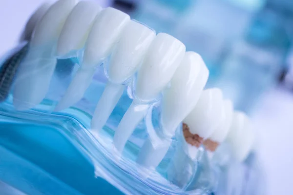 Tandarts Tandheelkundige Tanden Onderwijs Model Weergegeven Elk Tanden Tandvlees Voor — Stockfoto