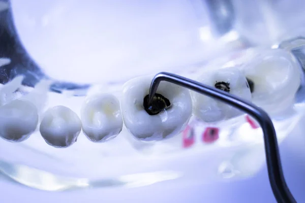 Denti Pulizia Dentistica Con Strumento Scelta Dei Denti Metallo Titanio — Foto Stock