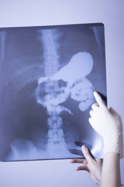 Tıbbi hastane röntgen lowe geri ağrı da mide ve organları gösteren omurga ve kalça Travmatoloji tarama.