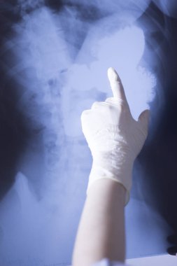 Tıbbi xray omurga kalça tarama