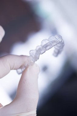 Görünmez diş diş aligners