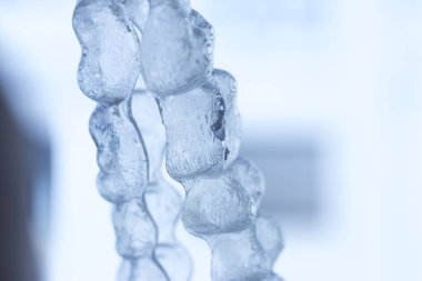 Görünmez köşeli ayraç diş aligners