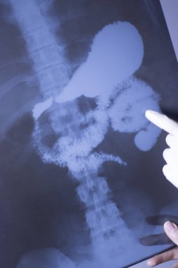 Tıbbi xray omurga kalça tarama