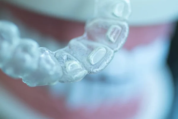 Dientes dentales invisibles alineadores — Foto de Stock