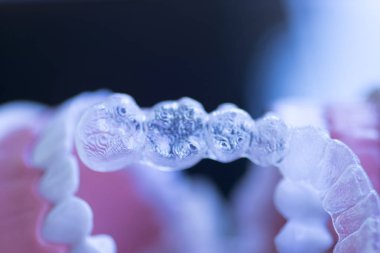 Görünmez diş diş aligners
