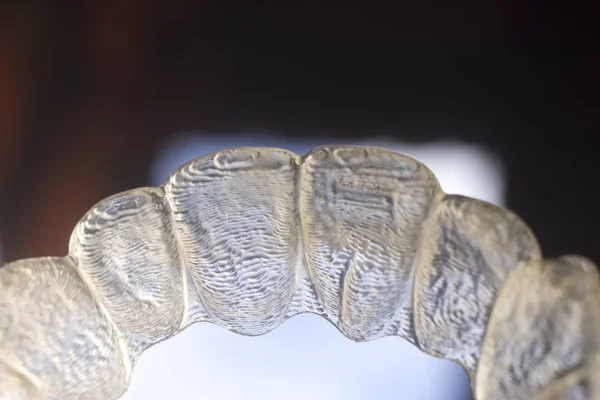 Allineatori denti staffa invisibile — Foto Stock