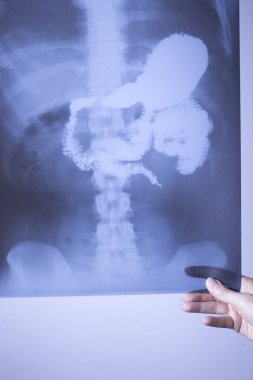 Tıbbi xray omurga kalça tarama