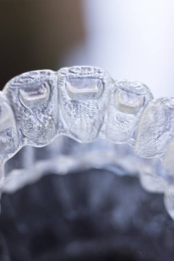 Görünmez diş diş aligners