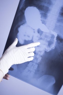 Tıbbi xray omurga kalça tarama