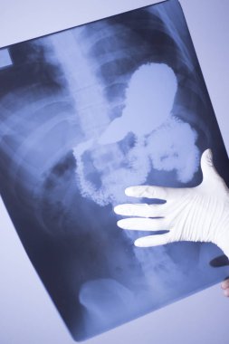 Tıbbi xray omurga kalça tarama
