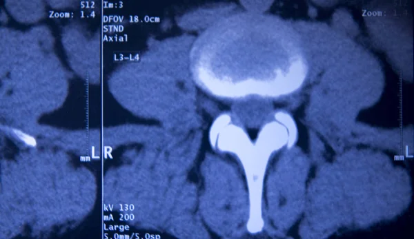 Lékařská kyčle hřbet MRI kontrola — Stock fotografie