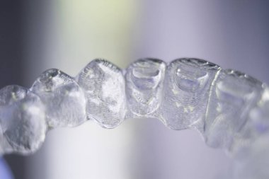 Görünmez diş diş aligners