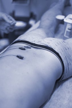 Epi kuru lingling fizyoterapi