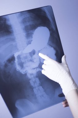 Tıbbi xray omurga kalça tarama