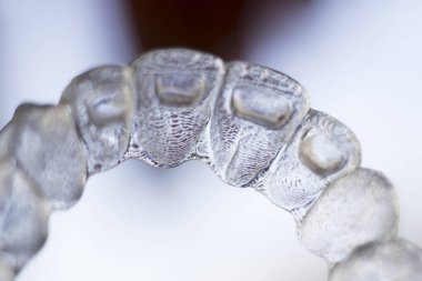 Görünmez diş diş aligners