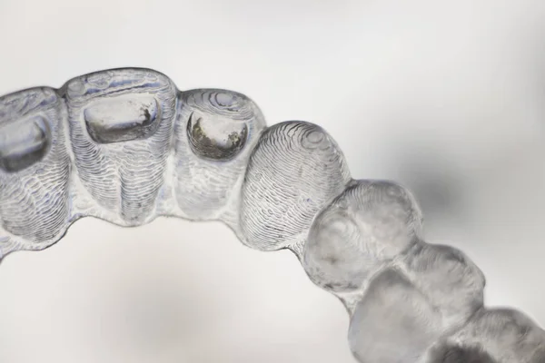 Dentes dentários invisíveis alinhadores — Fotografia de Stock