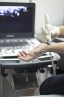 Epi kuru lingling ultrason taraması