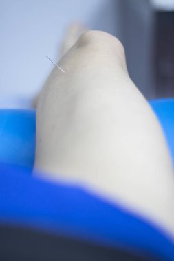 Epi kuru lingling ultrason taraması