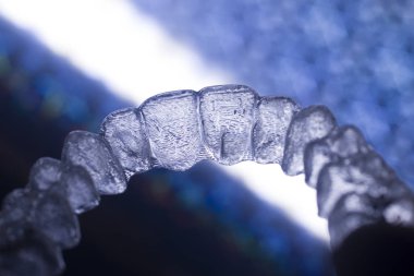 Diş braketleri diş hizalayıcıları