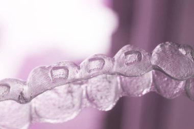 Görünmez köşeli ayraç diş aligners