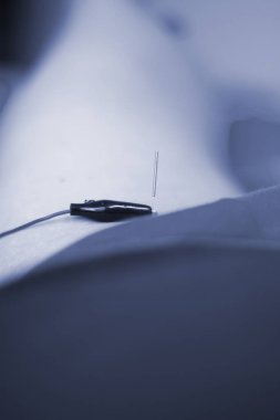 Epi kuru lingling ultrason taraması