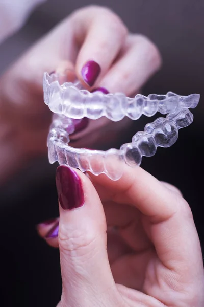 Retenedores dentales transparentes — Foto de Stock