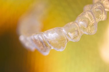 Diş braketleri diş hizalayıcıları