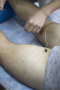 Epi kuru lingling fizyoterapi