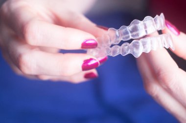 Modern dişçilik teknolojisindeki her dişi düzeltmek ve hizalamak için diş tellerini temizleyin..