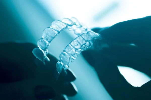 Abrazaderas Retención Dientes Dentales Transparentes Para Enderezar Alinear Cada Diente — Foto de Stock